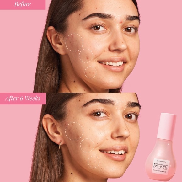 glow recipe niacinamide dew drops - Picture 2 of 2